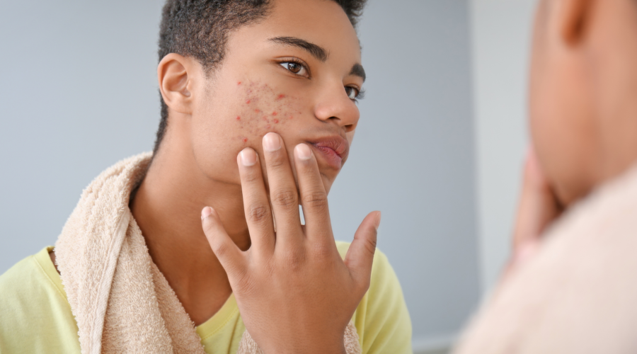 Unmasking Nature’s Secrets: Natural Remedies for Common Skin Issues