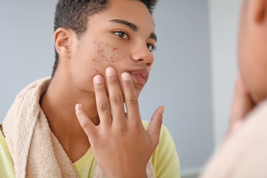 Unmasking Nature’s Secrets: Natural Remedies for Common Skin Issues